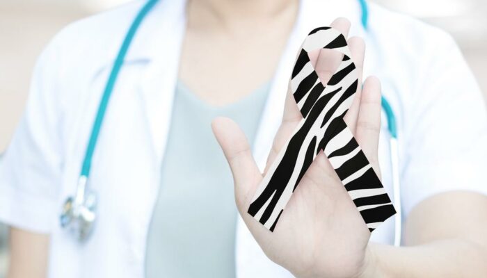 Carcinoid Neuroendocrine Tumors – Prognosis And Life Expectancy